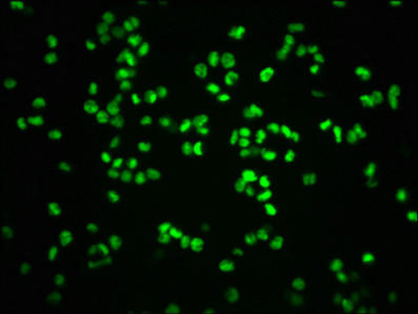 Anti-Phospho-RB1 (S807) Antibody (RACO0050)