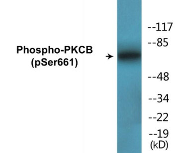 PKCB (Phospho-Ser661)Colorimetric Cell-Based ELISA Kit (CBCAB00497)