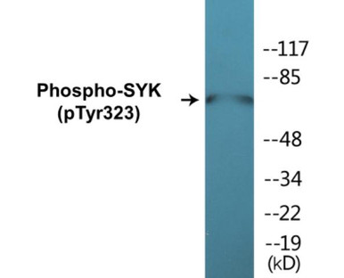 Phospho-Syk (Y323) (V5) Rabbit mAb