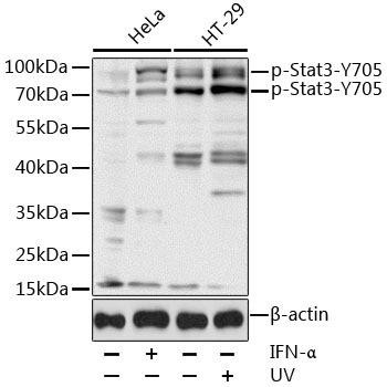 Phospho-STAT3-Y705 Antibody (CABP0070)
