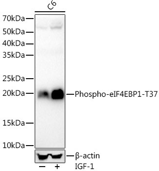 Phospho-eIF4EBP1 (Thr37) (D4) Rabbit mAb main image 1