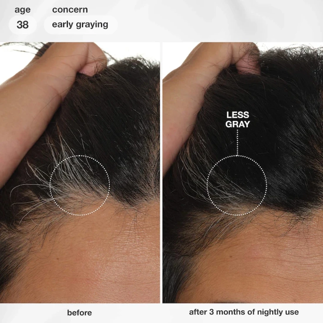K18 FutureIQ™ Hair Longevity Serum for Graying, Thinning & Scalp Aging