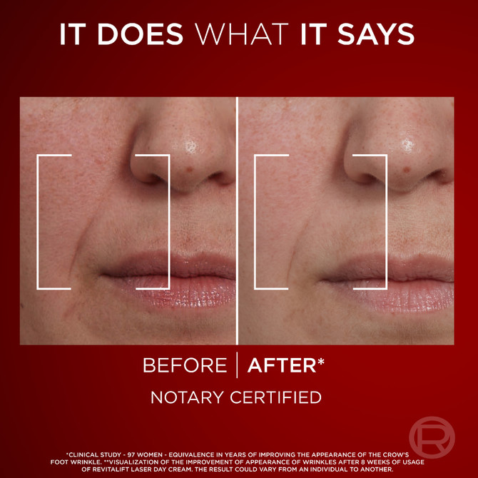 L'Oréal Paris Revitalift Laser X3 Anti-Ageing Day Cream SPF 15 50ml