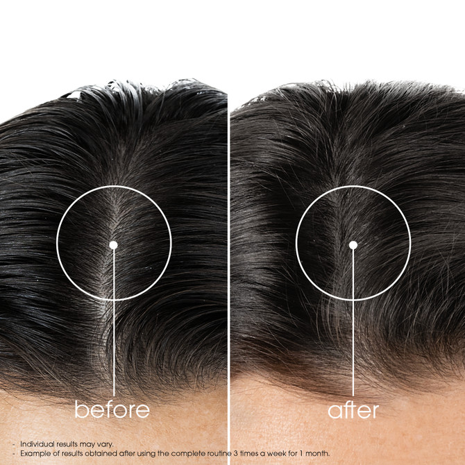 Klorane Strengthening Conditioner with Quinine and Organic Edelweiss 200ml - Thinning Hair