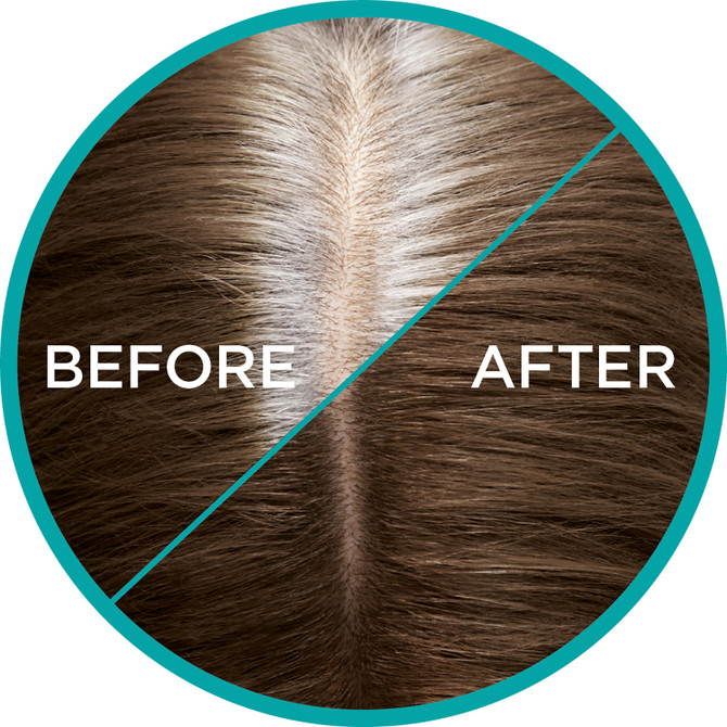 L'Oréal Paris Magic Retouch Temporary Root Concealer Spray - Cool Brown (Instant Grey Hair Coverage)