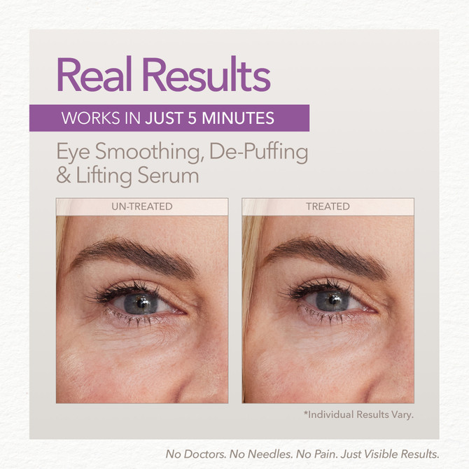 Skin Doctors™ Cosmeceuticals Instant Eyelift 10ml