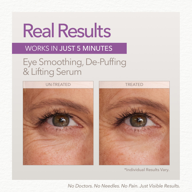 Skin Doctors™ Cosmeceuticals Instant Eyelift 10ml
