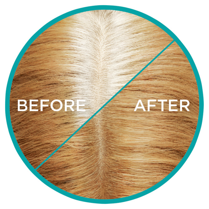 L'Oréal Paris Magic Retouch Temporary Root Concealer Spray, Blonde 9