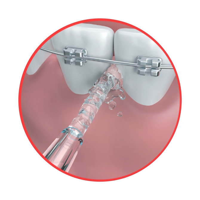 Dentagenie Water Flosser
