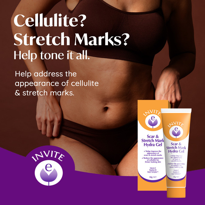 Invite E Scar & Stretch Mark Hydra Gel 50g