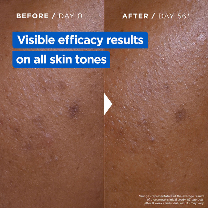 Mixa Niacinamide Bright Moisturising Anti-Dark Spot Cream 400ml