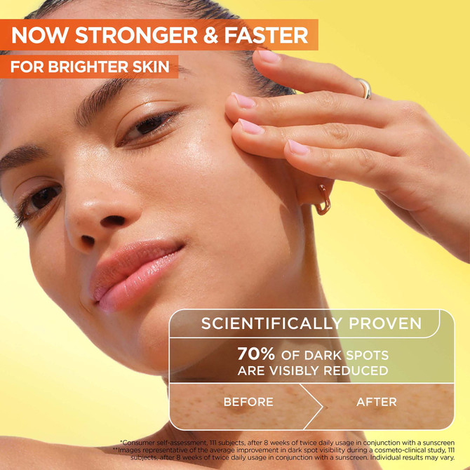 Garnier Vitamin C Brightening Serum with Melasyl 30mL, Advanced Dark Spot Treatment