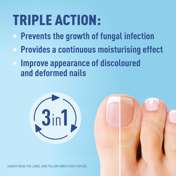 Duofilm by FungeX Nail Fungus Removal Patch 14pk