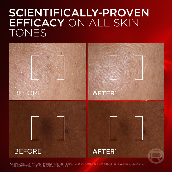L'ORÉAL PARIS REVITALIFT LASER MELASYL CREAMY-SERUM