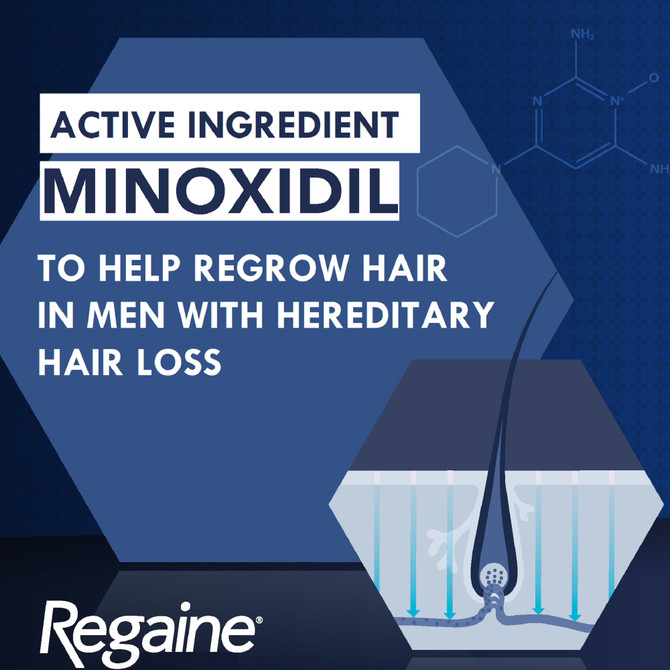Regaine Men’s Extra Strength 5% Minoxidil Topical Solution – Hair Regrowth Treatment for Men (1 Month Supply, 60mL)