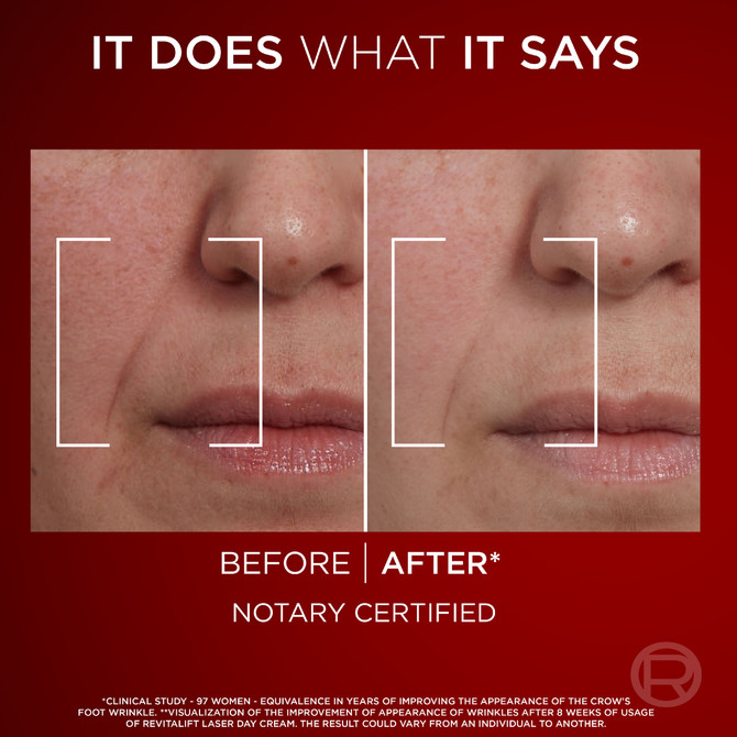 L'Oréal Paris Revitalift Laser X3 Anti-Ageing Day Cream 50ml