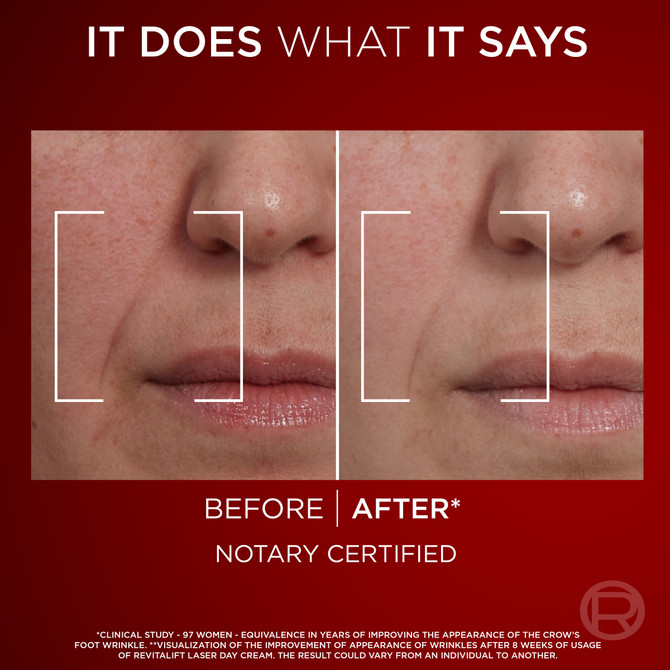 L'Oreal Revitalift Laser Anti-Ageing Day Cream 50ml