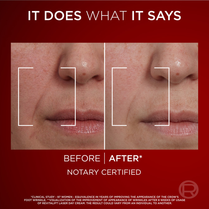 L'Oréal Paris Revitalift Laser X3 Anti-Ageing Night Cream 50ml