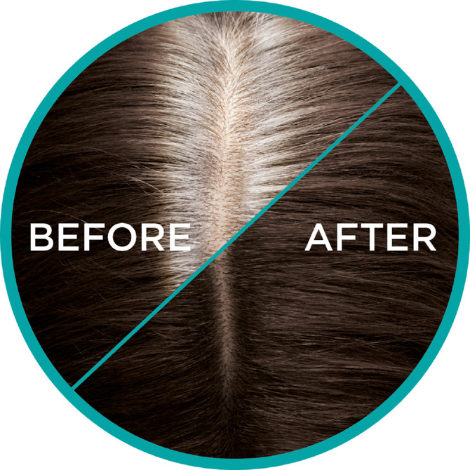 L'Oréal Paris Magic Retouch Temporary Root Concealer Spray - 2 Dark Brown