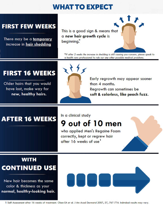 Men’s Regaine Extra Strength Foam 5% Minoxidil Hair Regrowth Treatment – Topical Hair Loss Treatment for Men (4 x 60g, 4 Month Supply)