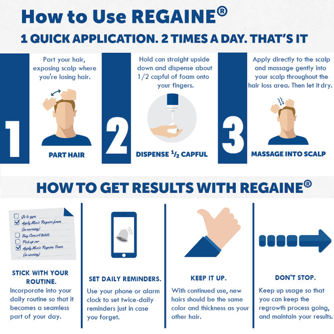 Men’s Regaine Extra Strength Foam 5% Minoxidil Hair Regrowth Treatment – Topical Hair Loss Treatment for Men (4 x 60g, 4 Month Supply)