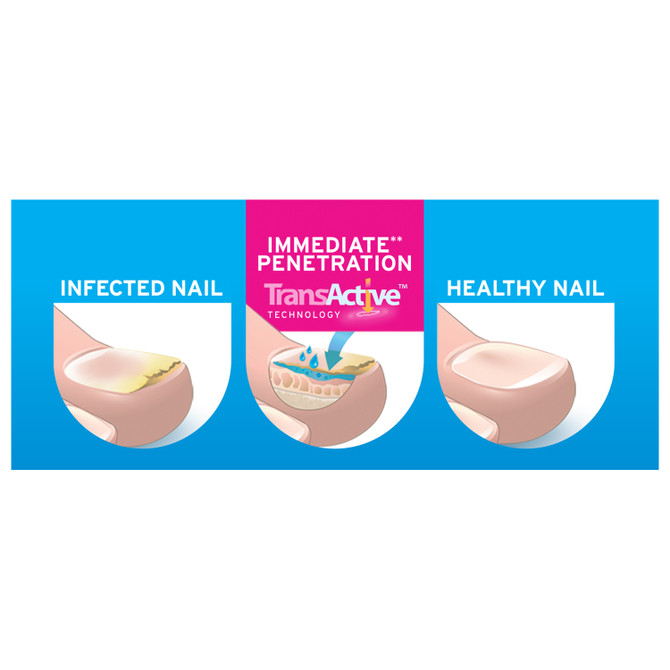 Excilor Treatment for Fungal Nail Infection Solution 3.3mL
