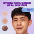 Benzac 3-in-1 Power Patch, Salicylic Acid Pimple Patches, For All Skin Types