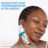CeraVe Blemish Control Resurfacing Retinol Serum 30ml