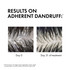 Dercos by Vichy Anti Dandruff DS Shampoo for Dry Hair 390ml