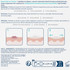 CeraVe Blemish Barrier Patches