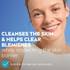 Stop Pimples Daily Wash Scrub 150mL