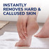 Dr.Scholl's™ Callus Hard Skin Manual File