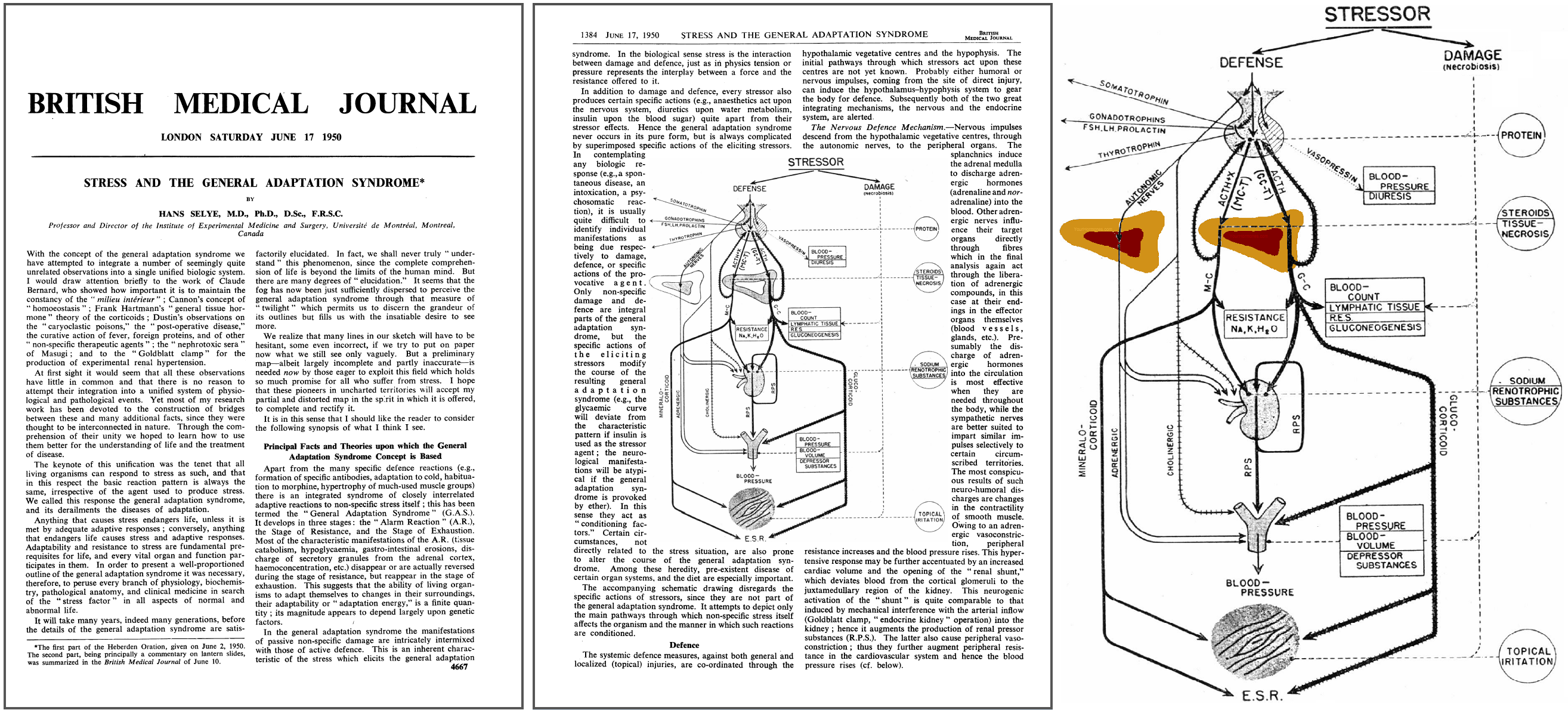 Adrenal Fatigue involves multible systems