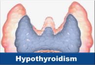 Learn the different causes and different types of hypothyroidism and low thyroid function including subclinical hypothyroidism, reverse T3 and natural therapy