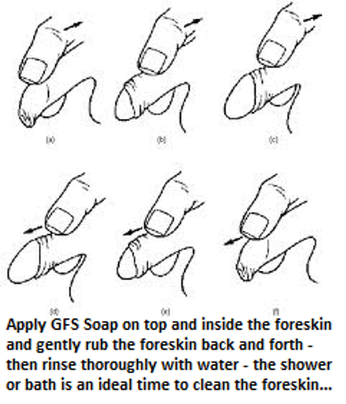NOVOGLAN Foreskin Cleaning Soap