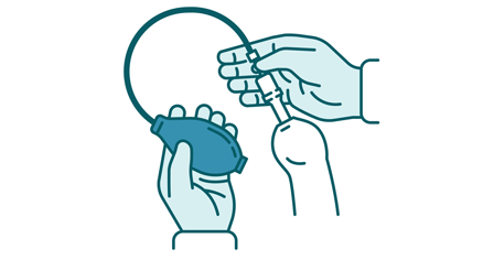 Step 2 – Inflate device