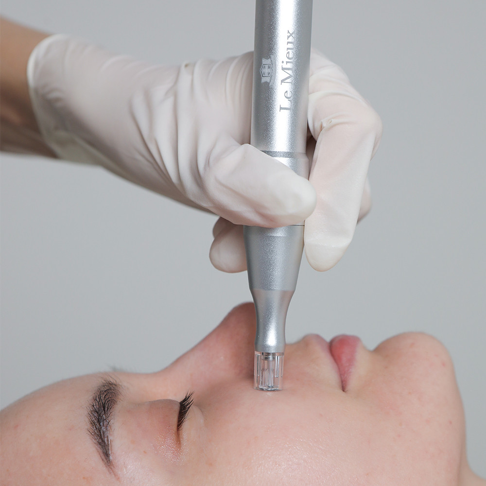 Derma Channel Nano Infusion Pen (Pro)