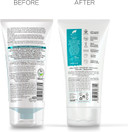 Dr Organic, Organic Skin Clear Face Scrub , Natural , Vegan , Cruelty Free , Paraben & Sls Free , Exfoliating , 150Ml