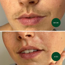 Nad'S Facial Wax Strips - Facial Hair Removal For Women - Waxing Kit With 48 Face Wax Strips + 8 Calming Oil Wipes + Skin Protection Powder