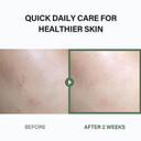 Celimax Ji.Woo.Gae Heartleaf Bha Peeling Pad (60 Pads*2) & The Real Noni Energy Ampoule 50Ml
