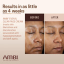 Ambi Even & Clear Fade Cream, Hydroquinone-Free, Hyperpigmentation Treatment, Dark Spot Corrector, Results In As Little As 4 Weeks, Niacinamide, Aloe Vera, Vitamin C, 1 Fl Oz