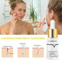 Lanbena Pore Minimizer Serum, Pore Minimizer & Reducer For Face, Minimizing, Shrinking, Oil Control Firming, Tightening Pores, 100% Vegan Pore Moisture After Blackhead Remover, 0.5 Fl.Oz Lanbena Pore Minimizer Serum, Pore Minimizer & Reducer For Face, Minimizing, Shrinking, Oil Control Firming, Tightening Pores, 100% Vegan Pore Moisture After Blackhead Remover, 0.5 Fl.Oz