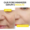 Lanbena Pore Minimizer Serum, Pore Minimizer & Reducer For Face, Minimizing, Shrinking, Oil Control Firming, Tightening Pores, 100% Vegan Pore Moisture After Blackhead Remover, 0.5 Fl.Oz Lanbena Pore Minimizer Serum, Pore Minimizer & Reducer For Face, Minimizing, Shrinking, Oil Control Firming, Tightening Pores, 100% Vegan Pore Moisture After Blackhead Remover, 0.5 Fl.Oz