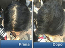 Pantogar (Pantovigar) Specific Treatment For Hair And Nails - 90 Cap