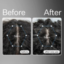 Act+Acre Cold Processed Apple Stem Cell Scalp Serum And Vitamin E Scalp Detox Oil - Promotes Growth - Soothes And Hydrates The Scalp - Dandruff And Dry Itchy Scalp