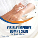 Gold Bond Rough & Bumpy Daily Skin Therapy Cream, 8 Oz., With 7 Moisturizers & 3 Vitamins8 Ounce (Pack Of 1)