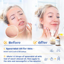 Hiqili 100Ml Spearmint Essential Oil For Skin Care -100% Pure Treatment Grade - 3.38 Fl Oz