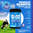 Collagen Peptides Powder With Super Greens - Hydrolyzed Collagen Type I & Iii For Hair, Skin, Nails & Joints  Superfoods, Digestive Enzymes, Grass-Fed, Non-Gmo, Unflavored - 30 Servings