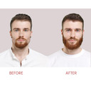 Biotin Hair Growth Shampoo For Men And Women - Treatment For Thinning Hair And Hair Loss - Biotin,Caffeine & Saw Palmetto Enriched Formula For Hair Thickening And Regrowth Dht Blocker 13.5 Floz