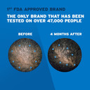 Menã¢ÂS Rogaine 5% Minoxidil Topical Foam, One Month Supply Menã¢ÂS Rogaine 5% Minoxidil Topical Foam, One Month Supply